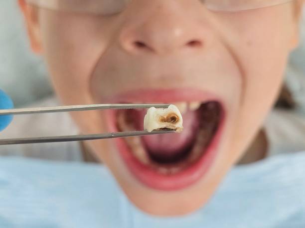 Best Emergency Pediatric Dental Care in Granite Hills, CA